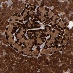 SEMA3G Antibody, Novus Biologicals 25 &mu;L; Unlabeled:Antibodies, Polyclonal