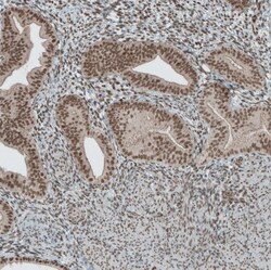 SENP1 Antibody, Novus Biologicals 0.1mL; Unlabeled:Antibodies, Polyclonal