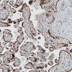 SENP1 Antibody, Novus Biologicals 0.1mL; Unlabeled:Antibodies, Polyclonal