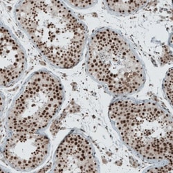 SENP1 Antibody, Novus Biologicals 0.1mL; Unlabeled:Antibodies, Polyclonal