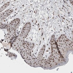 SENP6 Antibody, Novus Biologicals 0.1 mL | Buy Online | Novus Biologicals | Fisher Scientific