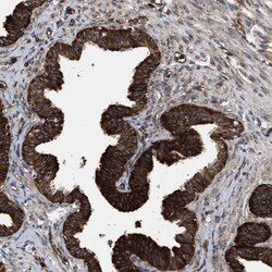 SERBP1 Antibody, Novus Biologicals 25 &mu;L | Buy Online | Novus Biologicals | Fisher Scientific
