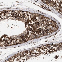 SERBP1 Antibody, Novus Biologicals 25 &mu;L | Buy Online | Novus Biologicals | Fisher Scientific