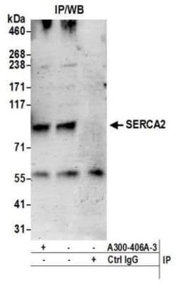 SERCA2 ATPase Antibody, Novus Biologicals 100 &mu;L | Buy Online | Novus Biologicals | Fisher Scientific