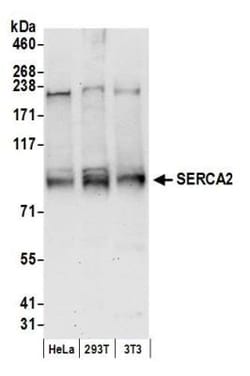 SERCA2 ATPase Antibody, Novus Biologicals 100 &mu;L | Buy Online | Novus Biologicals | Fisher Scientific