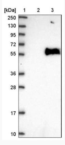 SERINC1 Antibody, Novus Biologicals 0.1mL; Unlabeled:Antibodies, Polyclonal