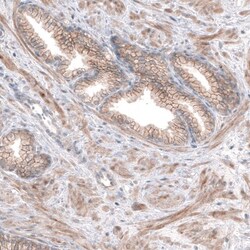 SERINC5 Antibody, Novus Biologicals 25 &mu;L, Unlabeled:Antibodies, Polyclonal