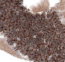 SERPINE3 Antibody, Novus Biologicals:Antibodies:Primary Antibodies