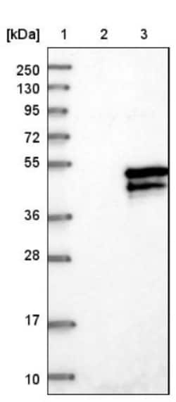 SERTAD2 Antibody, Novus Biologicals 0.1mL; Unlabeled:Antibodies, Polyclonal