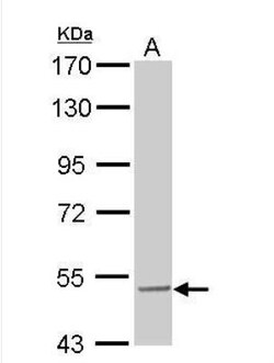 SESN3 Antibody, Novus Biologicals 0.1mg; Unlabeled:Antibodies, Polyclonal