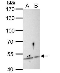 SESN3 Antibody, Novus Biologicals 0.1mg; Unlabeled:Antibodies, Polyclonal