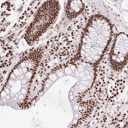 SET Antibody, Novus Biologicals:Antibodies:Primary Antibodies