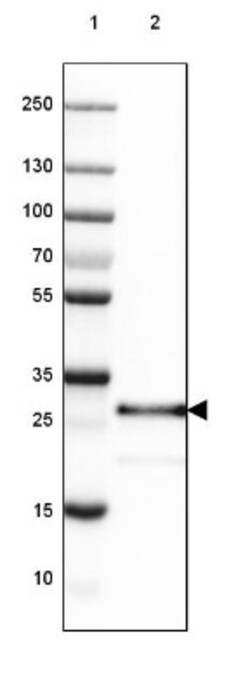 SET Antibody, Novus Biologicals:Antibodies:Primary Antibodies