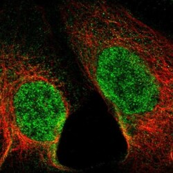SET1B Antibody, Novus Biologicals:Antibodies:Primary Antibodies