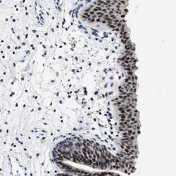 SET1B Antibody, Novus Biologicals:Antibodies:Primary Antibodies