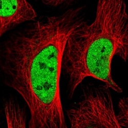 SETD5 Antibody, Novus Biologicals:Antibodies:Primary Antibodies