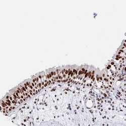 SETD5 Antibody, Novus Biologicals:Antibodies:Primary Antibodies