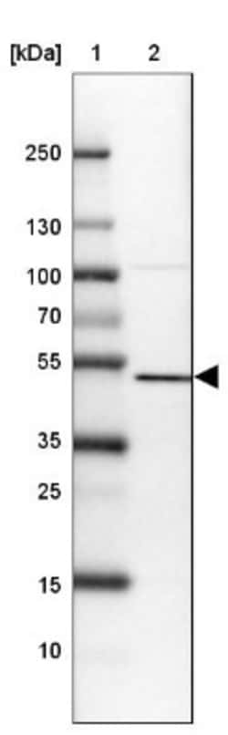 SETD7 Antibody, Novus Biologicals 25 &mu;L, Unlabeled:Antibodies, Polyclonal
