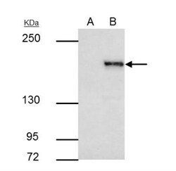 SETDB1 Antibody, Novus Biologicals 0.1mL; Unlabeled:Antibodies, Polyclonal