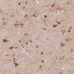SEZ6L2/BSRP-A Antibody, Novus Biologicals 25 &mu;L, Unlabeled:Antibodies,