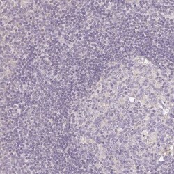 SEZ6L2/BSRP-A Antibody, Novus Biologicals 25 &mu;L, Unlabeled:Antibodies,