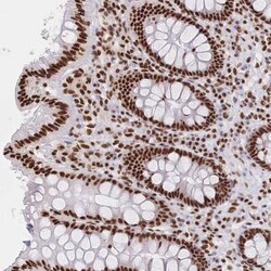 SF2 Antibody, Novus Biologicals:Antibodies:Primary Antibodies