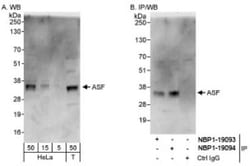 SF2 Antibody, Novus Biologicals 0.1mL; Unlabeled:Antibodies, Polyclonal