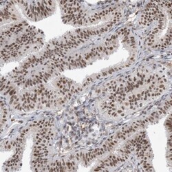 SF3A3 Antibody, Novus Biologicals 0.1mL; Unlabeled:Antibodies, Polyclonal