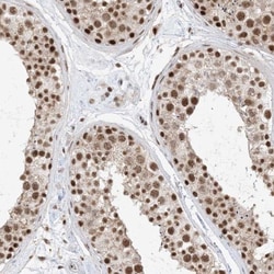 SF3A3 Antibody, Novus Biologicals 0.1mL; Unlabeled:Antibodies, Polyclonal