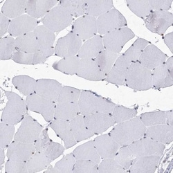 SF3B14 Antibody, Novus Biologicals:Antibodies:Primary Antibodies