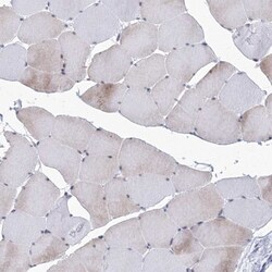 SF3B14 Antibody, Novus Biologicals 0.1mL; Unlabeled:Antibodies, Polyclonal