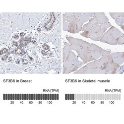 SF3B14 Antibody, Novus Biologicals 0.1mL; Unlabeled:Antibodies, Polyclonal