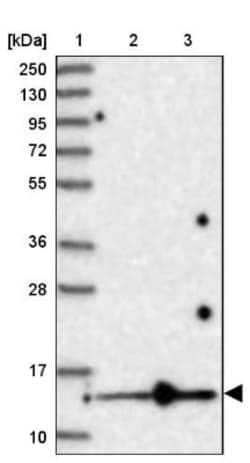 SF3B14 Antibody, Novus Biologicals:Antibodies:Primary Antibodies