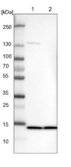 SF3B14 Antibody, Novus Biologicals 0.1mL; Unlabeled:Antibodies, Polyclonal