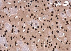 SFPQ Antibody, Novus Biologicals 0.1mL; Unlabeled:Antibodies, Polyclonal