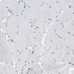 SFRS12 Antibody, Novus Biologicals 0.1 mL | Buy Online | Novus Biologicals | Fisher Scientific