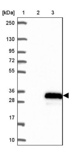 SFRS12IP1 Antibody, Novus Biologicals 0.1 mL | Buy Online | Novus Biologicals | Fisher Scientific