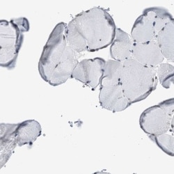 SFRS15 Antibody, Novus Biologicals:Antibodies:Primary Antibodies