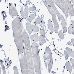 SFRS15 Antibody, Novus Biologicals:Antibodies:Primary Antibodies