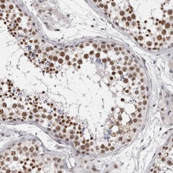 SFRS15 Antibody, Novus Biologicals 0.1mL; Unlabeled:Antibodies, Polyclonal
