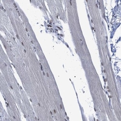 SFRS15 Antibody, Novus Biologicals 0.1mL; Unlabeled:Antibodies, Polyclonal