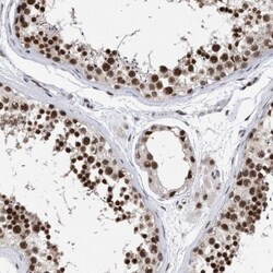 SFRS15 Antibody, Novus Biologicals 0.1mL; Unlabeled:Antibodies, Polyclonal