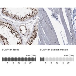 SFRS15 Antibody, Novus Biologicals 0.1mL; Unlabeled:Antibodies, Polyclonal