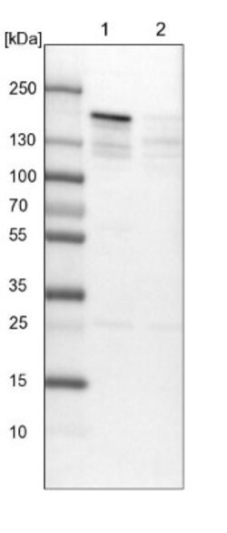 SFRS15 Antibody, Novus Biologicals 0.1mL; Unlabeled:Antibodies, Polyclonal