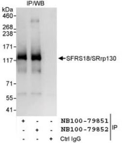 SFRS18 Antibody, Novus Biologicals 0.1mL; Unlabeled:Antibodies, Polyclonal