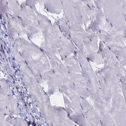 SFRS7 Antibody, Novus Biologicals 25 &mu;L, Unlabeled:Antibodies, Polyclonal