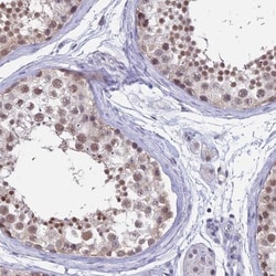 SFRS7 Antibody, Novus Biologicals 25 &mu;L, Unlabeled:Antibodies, Polyclonal