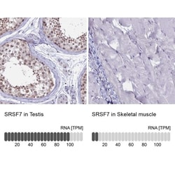SFRS7 Antibody, Novus Biologicals 25 &mu;L, Unlabeled:Antibodies, Polyclonal