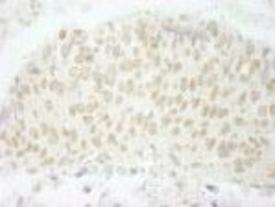 SFRS8 Antibody, Novus Biologicals 0.1mL; Unlabeled:Antibodies, Polyclonal