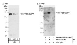 SFRS8 Antibody, Novus Biologicals 0.1mL; Unlabeled:Antibodies, Polyclonal